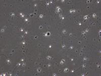 Sperm Head-Neck-Tail Segment project thumbnail
