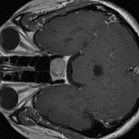 brain project thumbnail