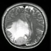 brain project thumbnail