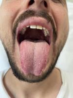 tongue_analyze project thumbnail