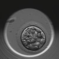 Embryo Segmentation project thumbnail