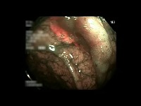 scopy project thumbnail