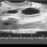 follicle segmentation project thumbnail