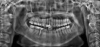 panoramica_tooth01 project thumbnail