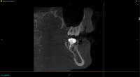 Dental Project 2 project thumbnail