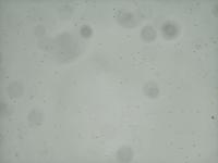 CR detection project thumbnail