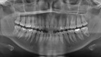 Dental Age project thumbnail