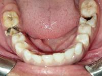 cavity project thumbnail