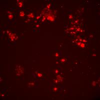 DetectMitosis project thumbnail