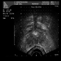 prostate_data project thumbnail