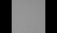 RAW264.7 Ctrl/M1/M2_BF project thumbnail