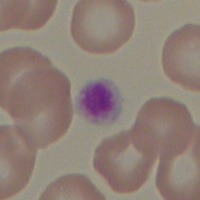 'blood cell identification' Object Detection Model by Cure Radar Inc