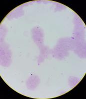 malaria_movie 2 project thumbnail