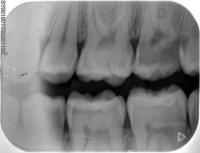 Dental AI Clinic project thumbnail
