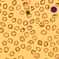 WBC - Smear project thumbnail