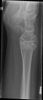 wrist-xrays project thumbnail