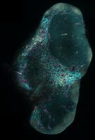 lymph-node-ground-truth-full-segmentation-downsampled project thumbnail