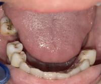 TEETH EDGE DETECTION project thumbnail