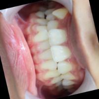fixlabial project thumbnail