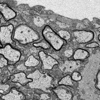 MicroStructFormer-MouseSpinalCord-EM-Ultrastructure-Segmentation project thumbnail