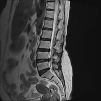 mri data project thumbnail