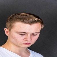 post acne project thumbnail