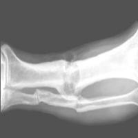 bone annotation checking project thumbnail