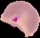 Malaria Dataset1 project thumbnail