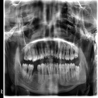 Dental x-ray AthiraMajinu label project thumbnail