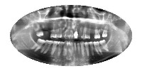Dental x-ray triparna18 project thumbnail