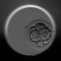 Embryo Fragmentation project thumbnail