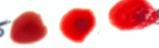 Blood Group project thumbnail