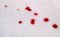 Identifying bloodstain using CNN project thumbnail