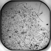 Dim Larvae/Sheath Segmentation project thumbnail