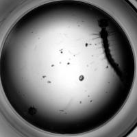 Mosquito Larvae Segmentation project thumbnail