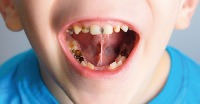 AAUP-Dental project thumbnail