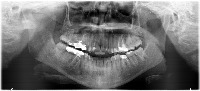 Teeth_annotation_sl_techno project thumbnail