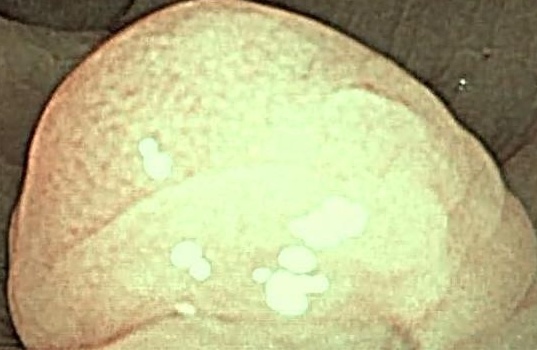 Pit Pattern Classification Dataset by ObjectDetection