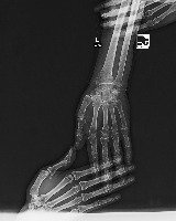 bone project thumbnail