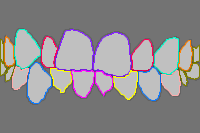 Annotation Visualization