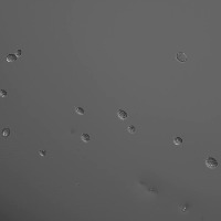 suctorian-segmentation project thumbnail