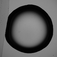 cell-detection project thumbnail