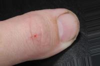 snake bite project thumbnail