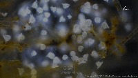 vorticella project thumbnail
