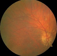 Dataset Image