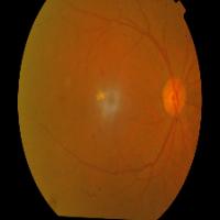 eye2 project thumbnail