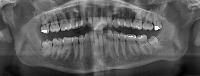 Mandibula Annotation project thumbnail