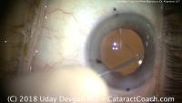 Veritas-Pupil project thumbnail