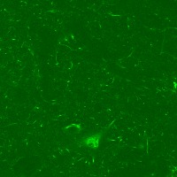 Neurons - Normal BB - New project thumbnail