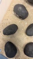 Nodule Detection project thumbnail